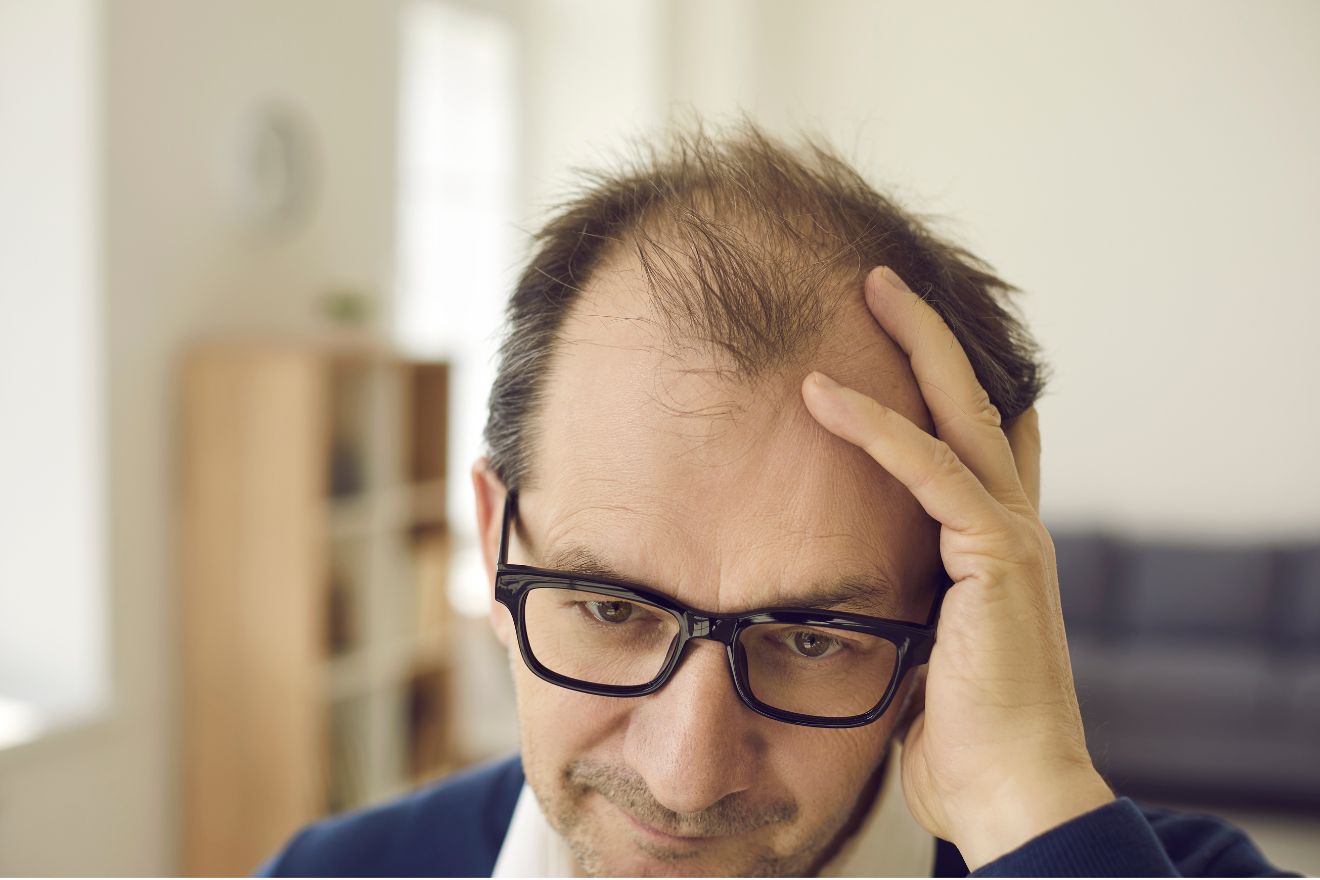 The Definitive Guide to Hair Loss and Hair Thinning Hair in Men
