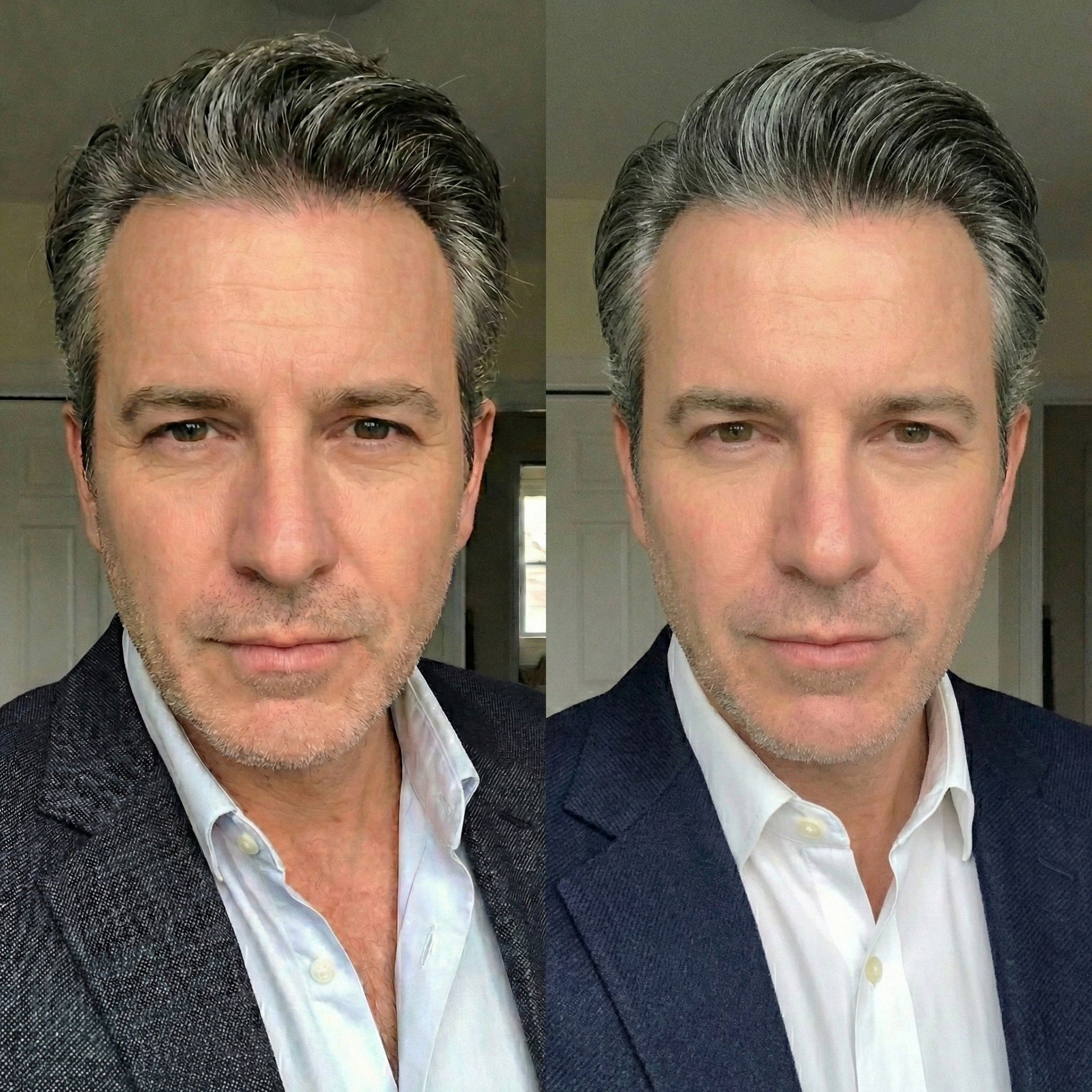 Man Before and After