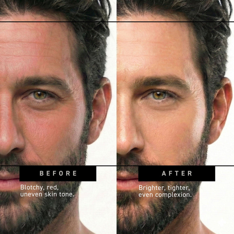 before and after