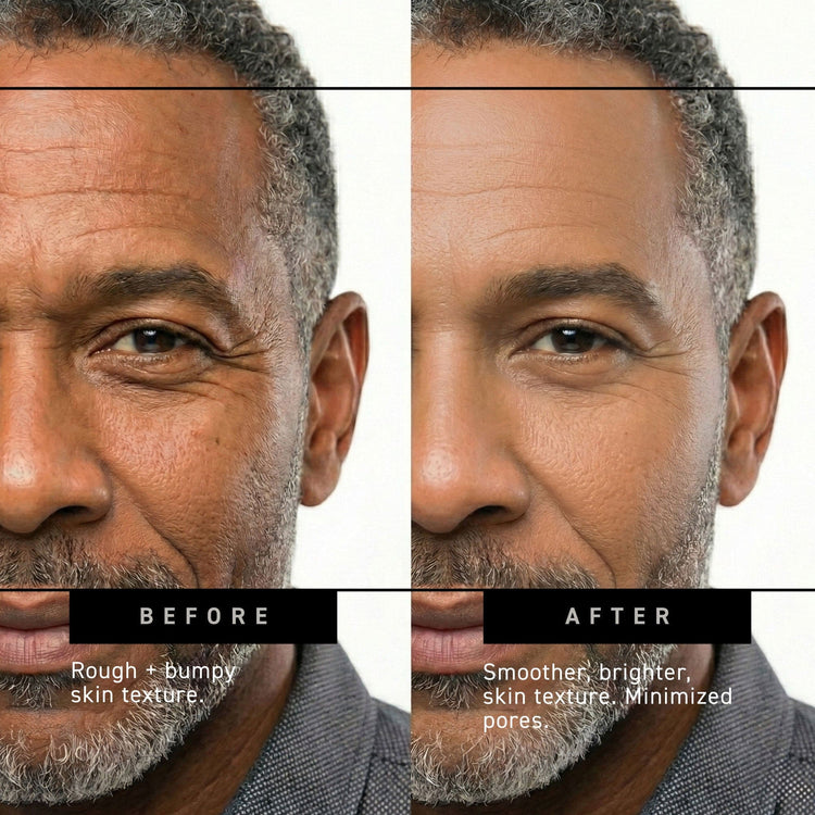 before and after