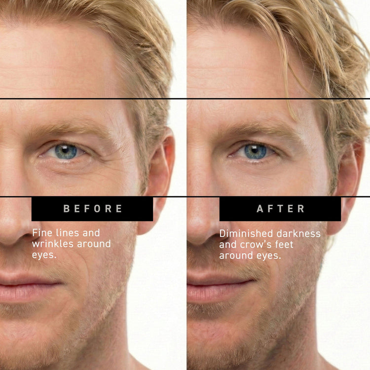 before and after