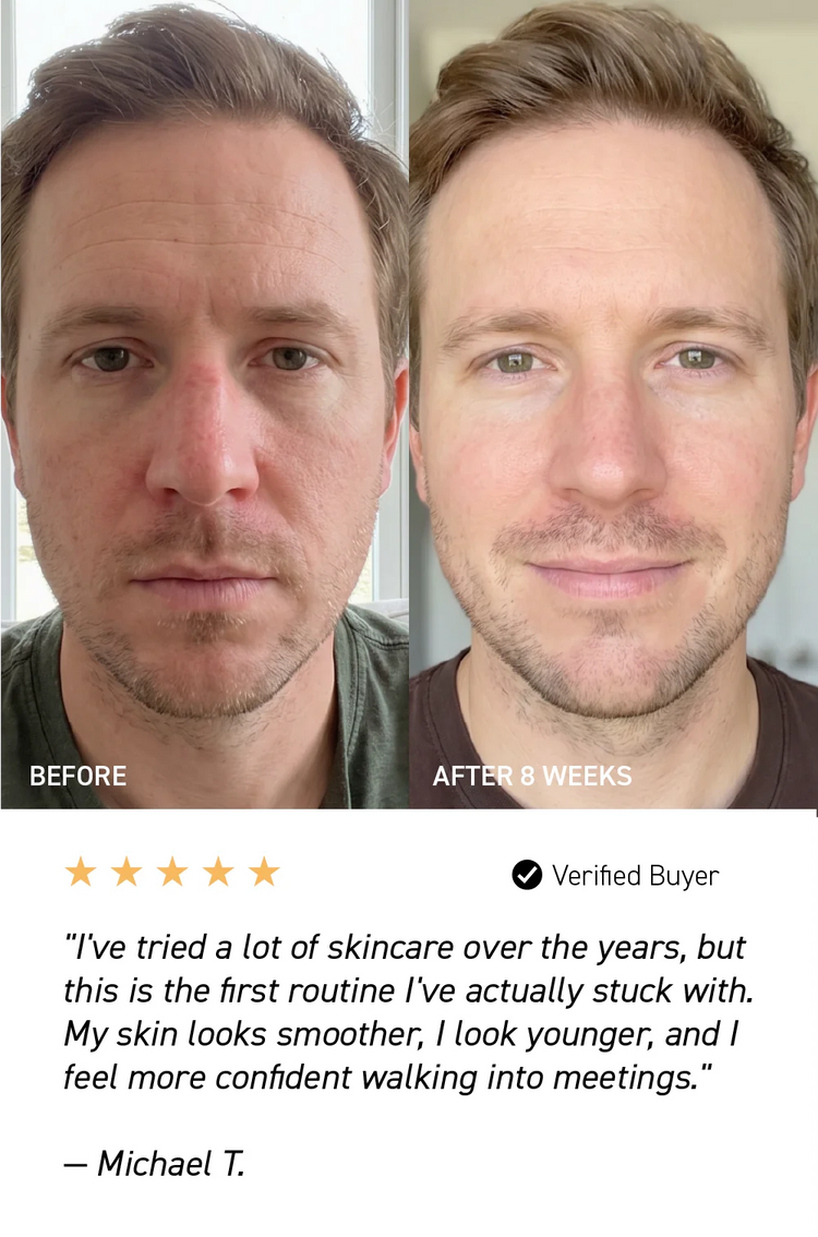 before and after