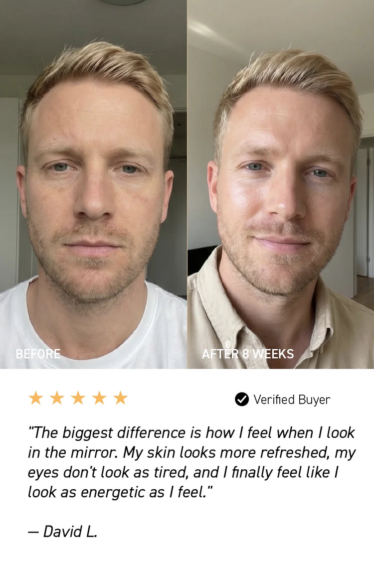 before and after